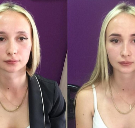  Анна Алферчик