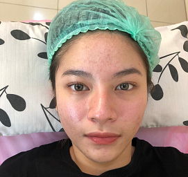 Yenny Hanafi Natakusumah 